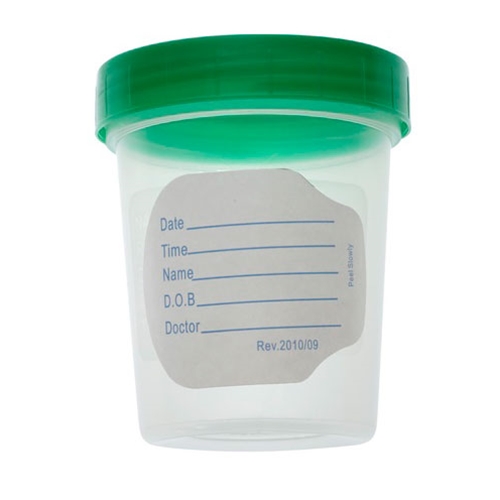 AMSure<sup>&reg;</sup> Urine Specimen Containers